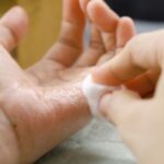 Cara Menghilangkan Lem Korea di Tangan dengan Aman dan Efektif