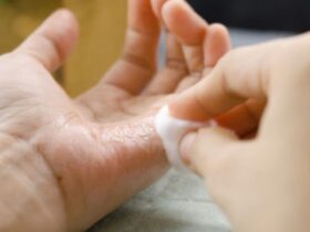 Cara Menghilangkan Lem Korea di Tangan dengan Aman dan Efektif